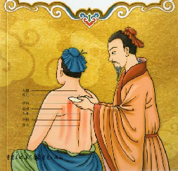 Illustration Moxibustion